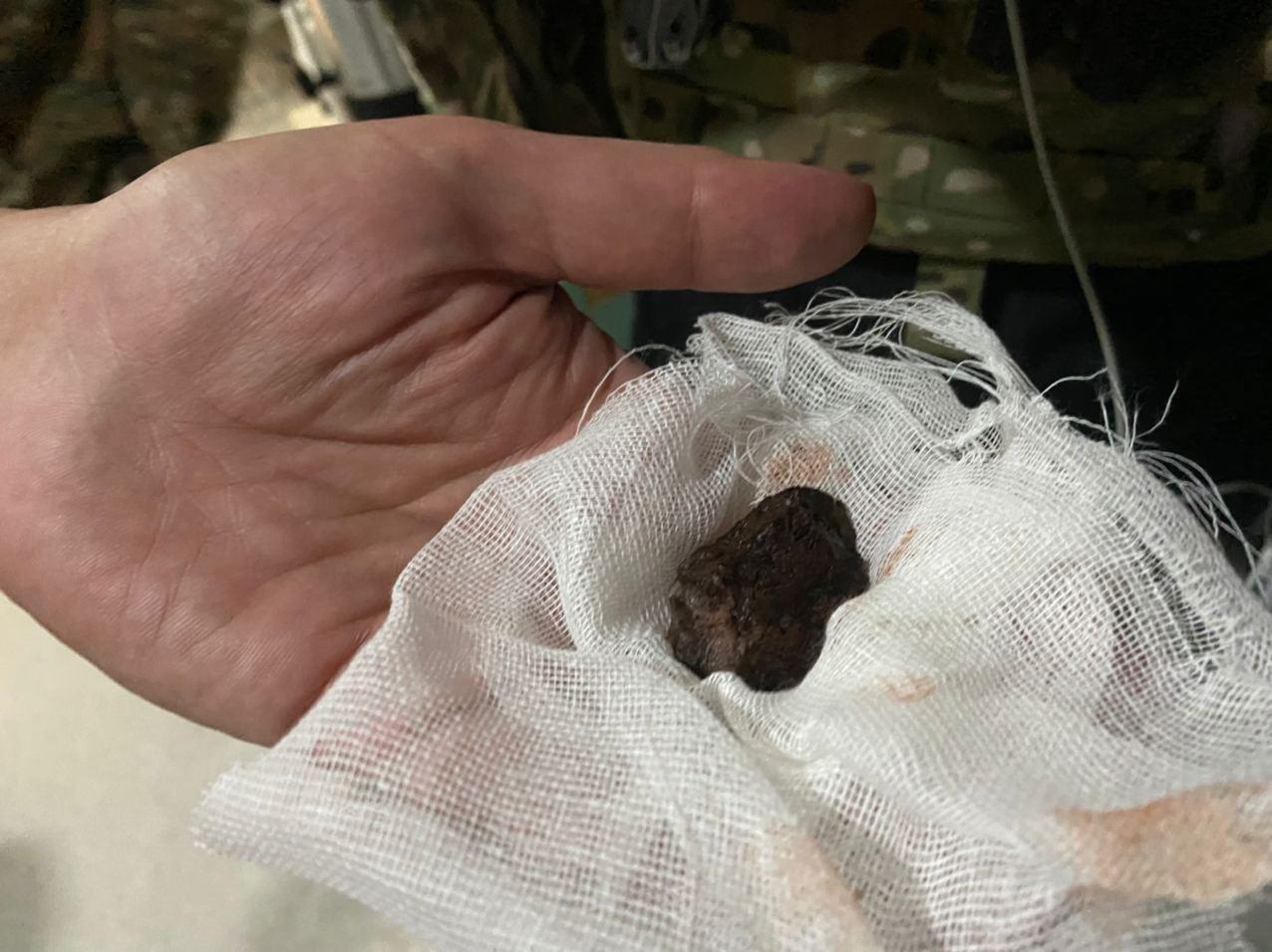 Осколок, который вытащили из бицепса Арзанова.