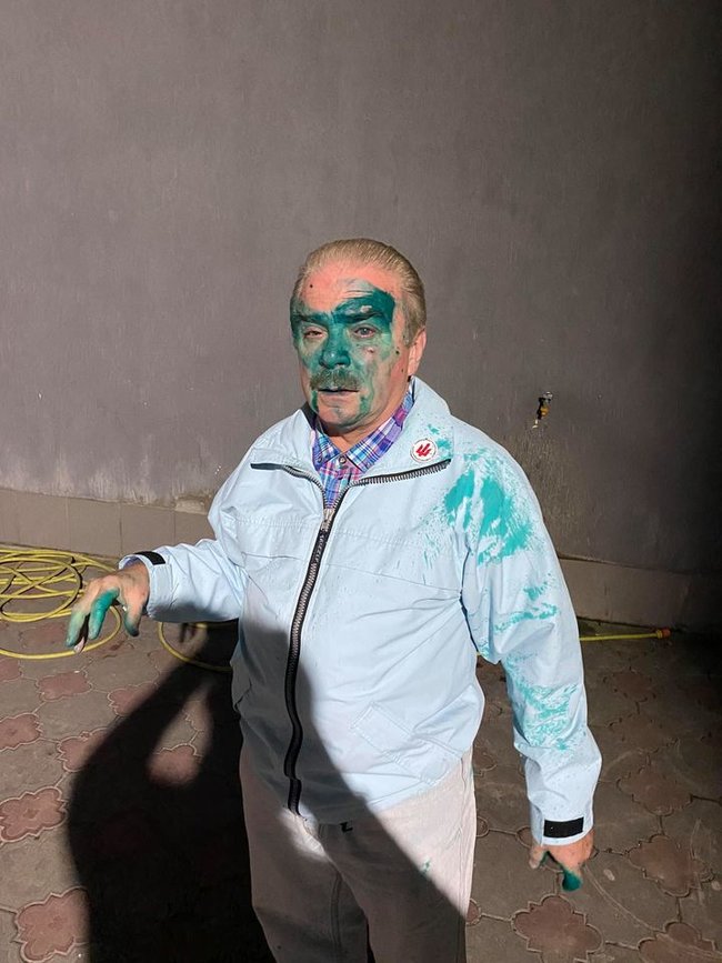 В Тернополе облили зеленкой кандидата на должность мэра от партии Ляшко Барну 02 В Тернополе облили зеленкой кандидата на должность мэра от партии Ляшко Барну 02 dqxikeidqxitkant