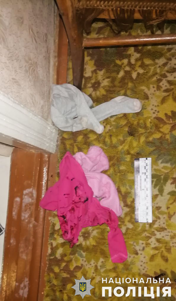 Мужчина облил жену и детей кислотой. Фото: Нацполиция dqxikeidqxitkant