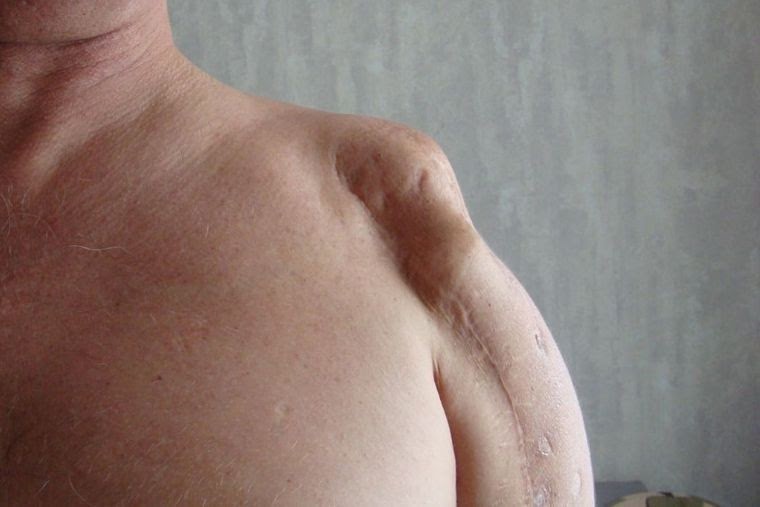 Ранение Святослава-Андрея Грушевского