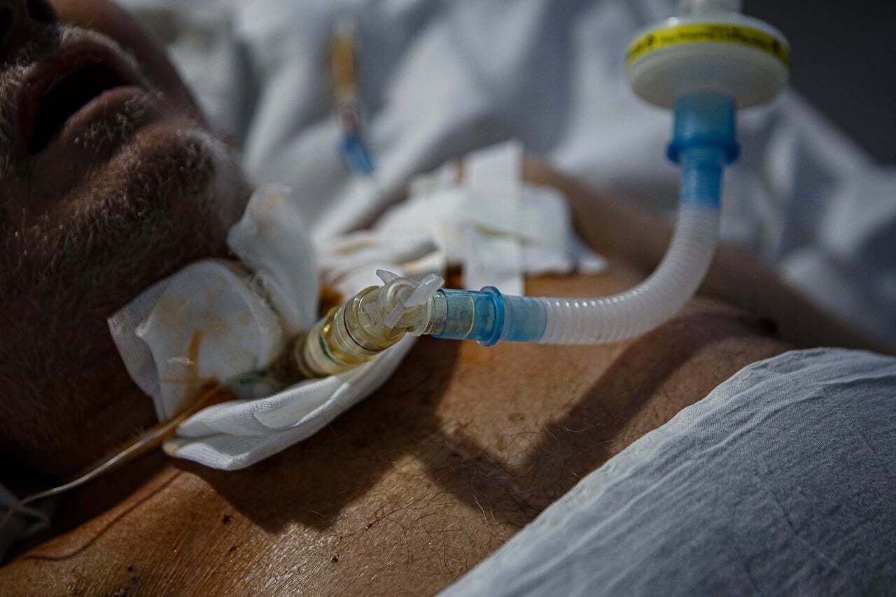 Пациент на кислородном аппарате в COVID-отделении Центра легочных болезней