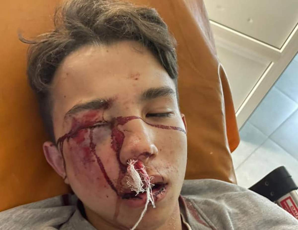 Сын народного депутата Кучеренко попал в аварию - фото 1 dqxikeidqxitkant