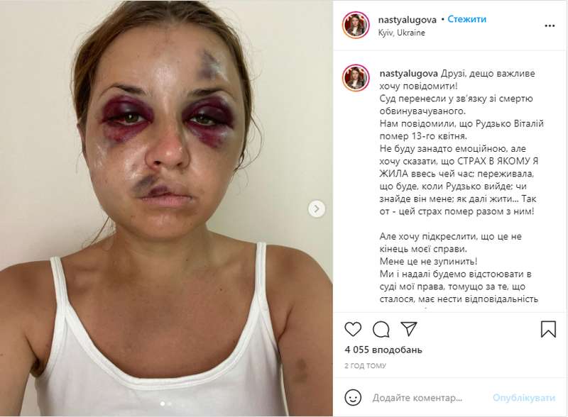  Instagram dqxikeidqxitkant