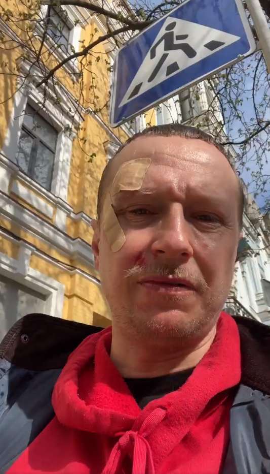 Винтонива избили за замечание о ПДД. dqxikeidqxitkant