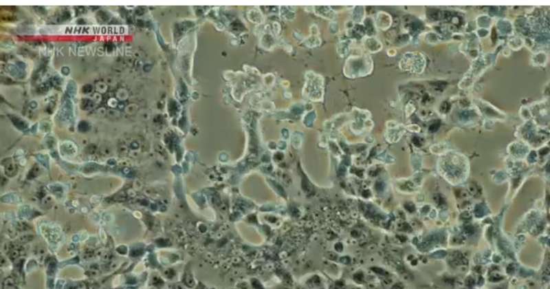 Ученые показали, как COVID-19 убивает клетки в организме. Фото