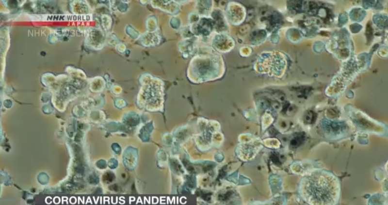 Ученые показали, как COVID-19 убивает клетки в организме. Фото