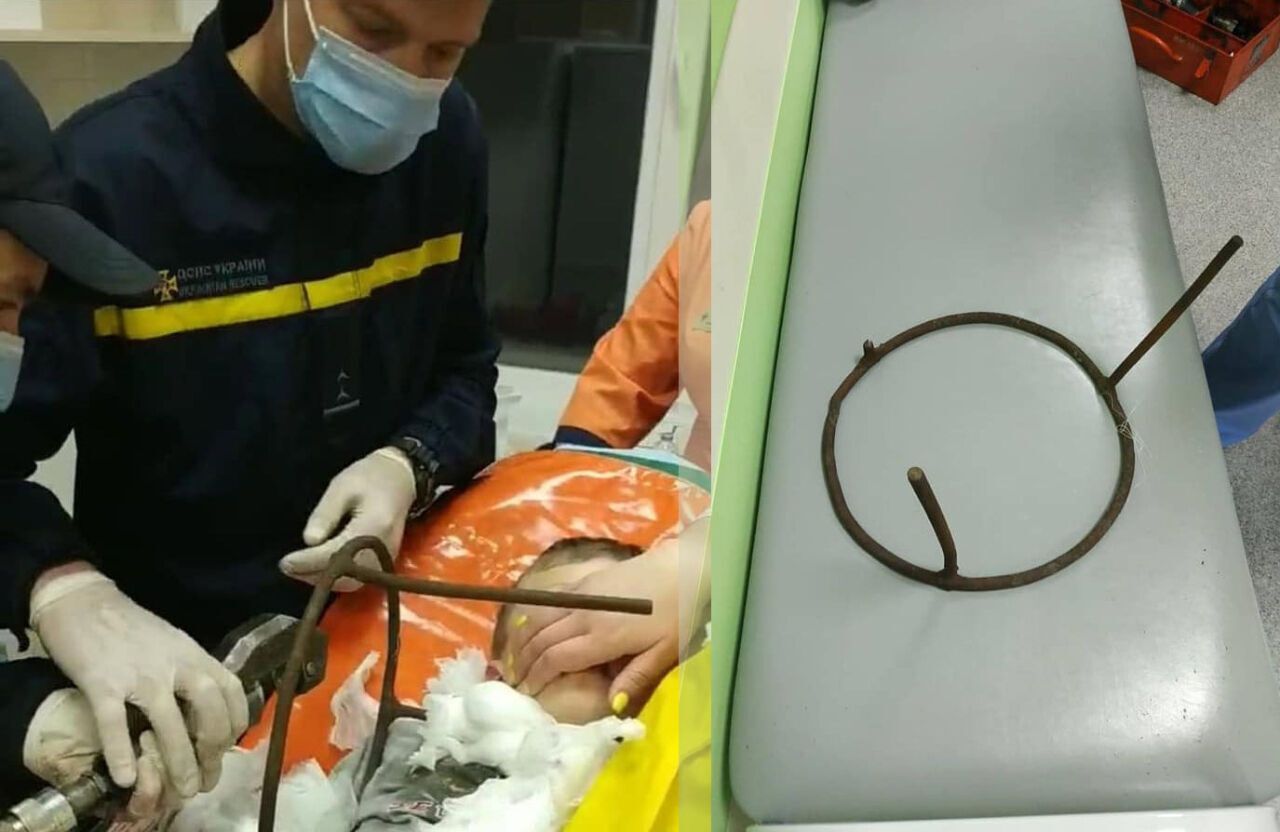 В Полтаве ребенок проткнул шею металлическим стулом dqxikeidqxiqqeant