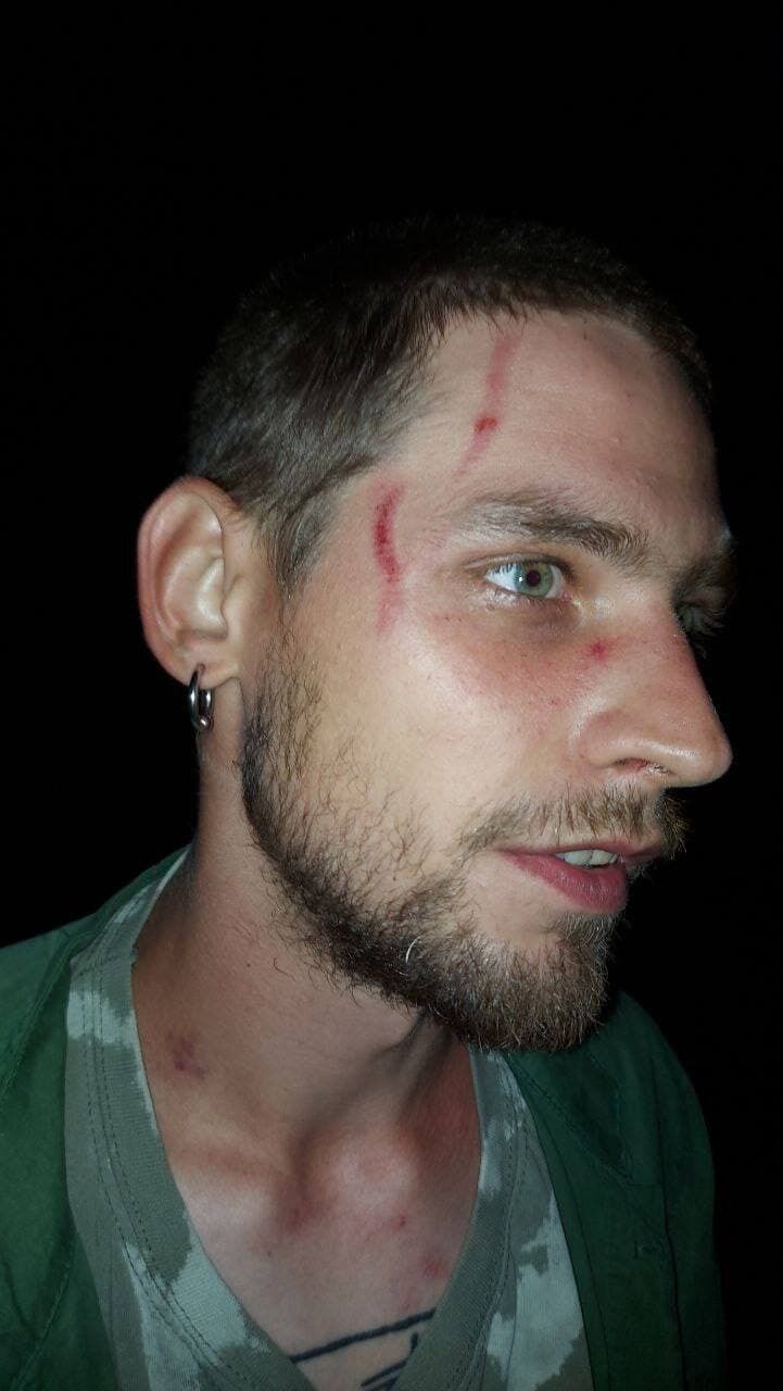 Павел Рабешко зафиксировал все следы побоев