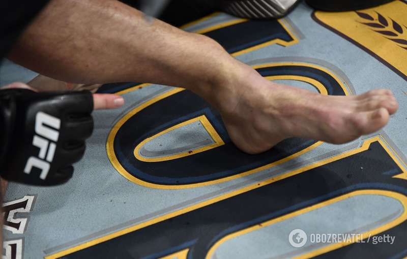 Сломанная нога МакГрегора.