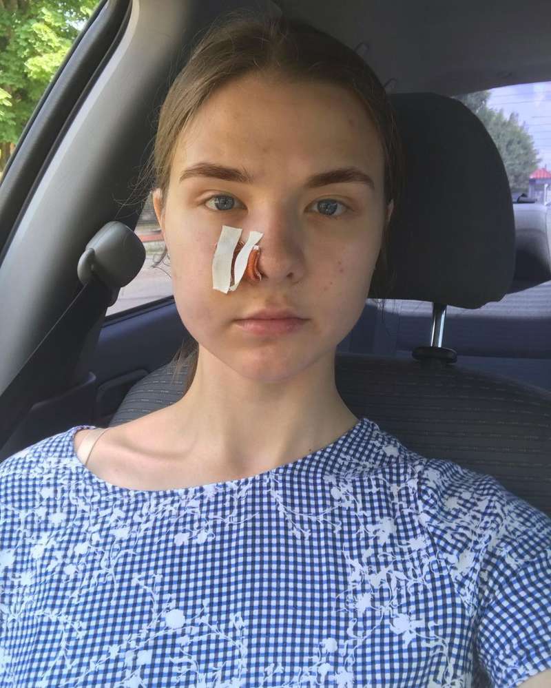 В лицо девушки выстрелили из dqxikeidqxitkant