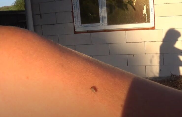 Комары кусают даже днем. dqxikeidqxiqqeant