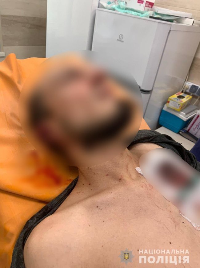 Конфликт между мужчинами на Черкасщине закончился стрельбой - два человека госпитализированы, - Нацполиция 01 dqxikeidqxiqqeant