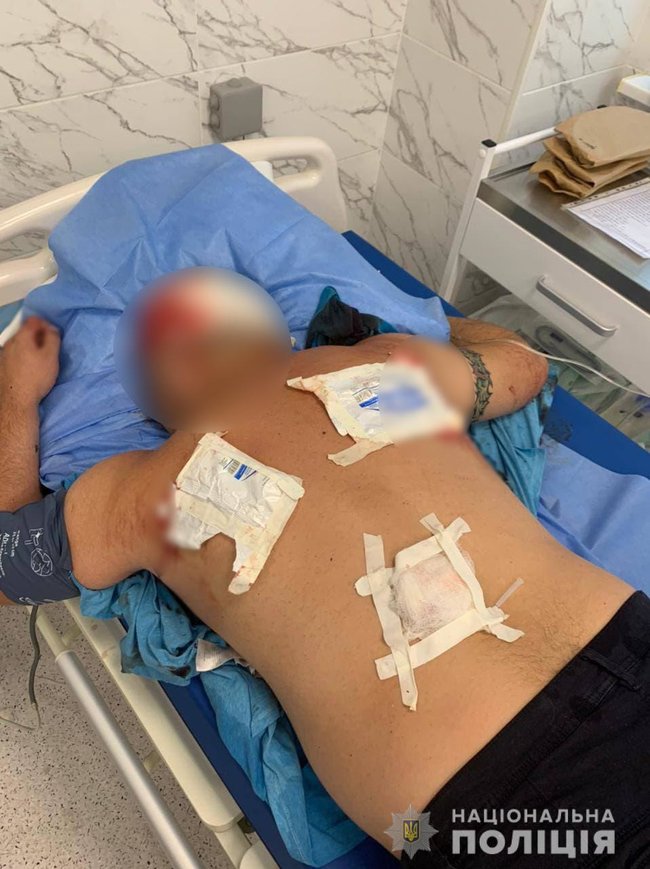 Конфликт между мужчинами на Черкасщине закончился стрельбой - два человека госпитализированы, - Нацполиция 02