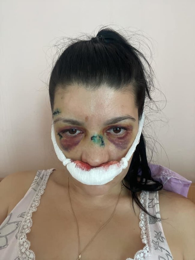 Меня избили за общественную деятельность и противодействие криминалитету. Вмешивать Филатова - глупость нариковских технологов, - правозащитница Эшонкулова 01 dqxikeidqxitkant