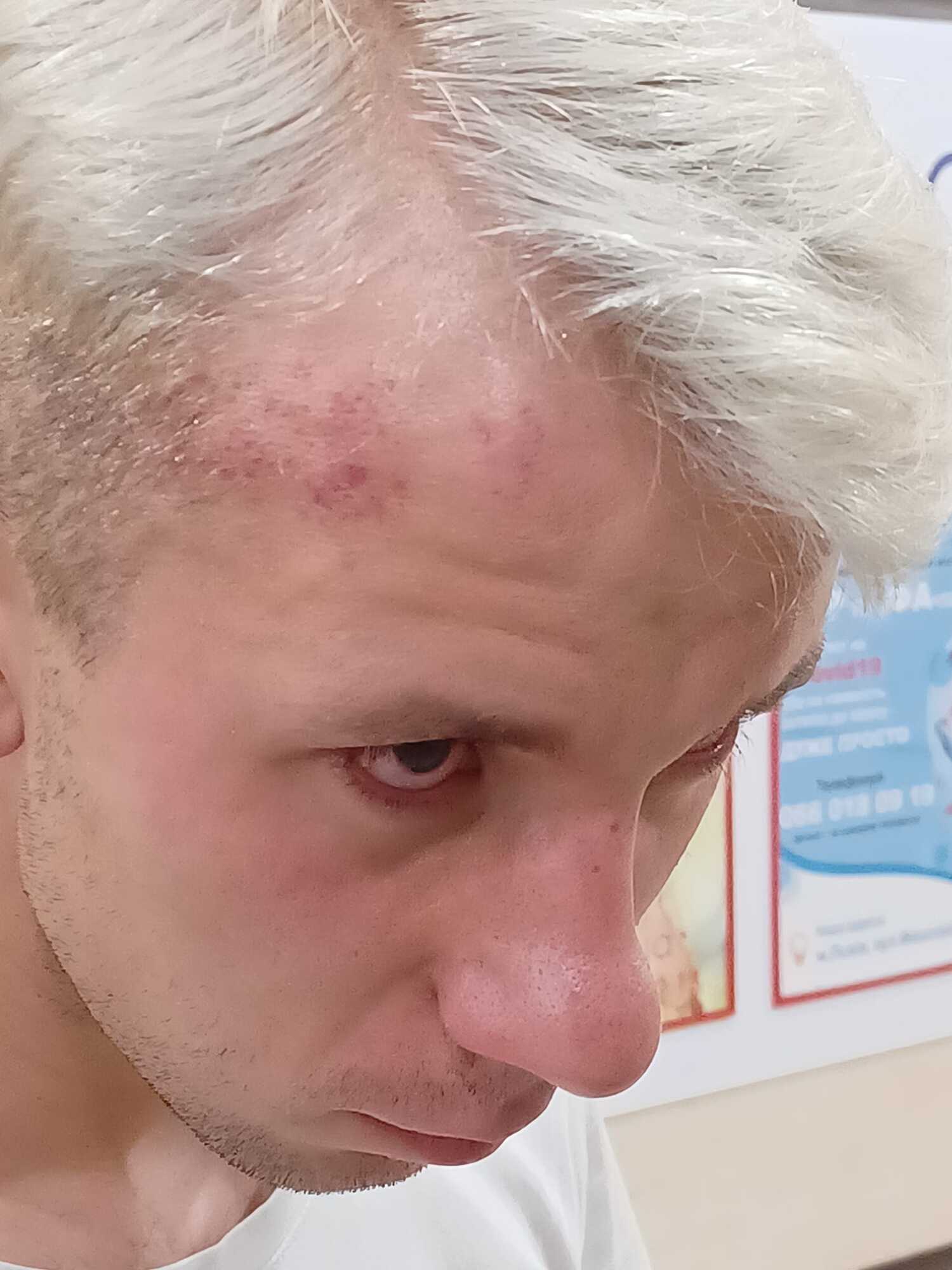 Раны у Максима Вербы