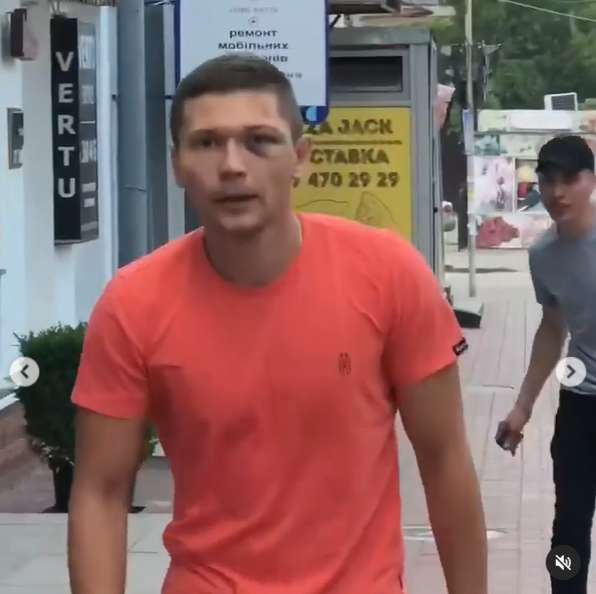 Танцора Нади Дорофеевой жестоко избили dqxikeidqxiqqeant