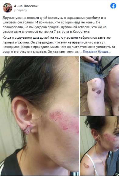 Депутата-"слугу" обвиняют в нападении на женщину 1 8ae26cba2f9f7f872b7d51e04dcf0195 dqxikeidqxiqqeant