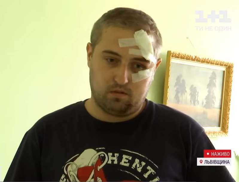 Турист с черепно-мозговой травмой dqxikeidqxiqqeant