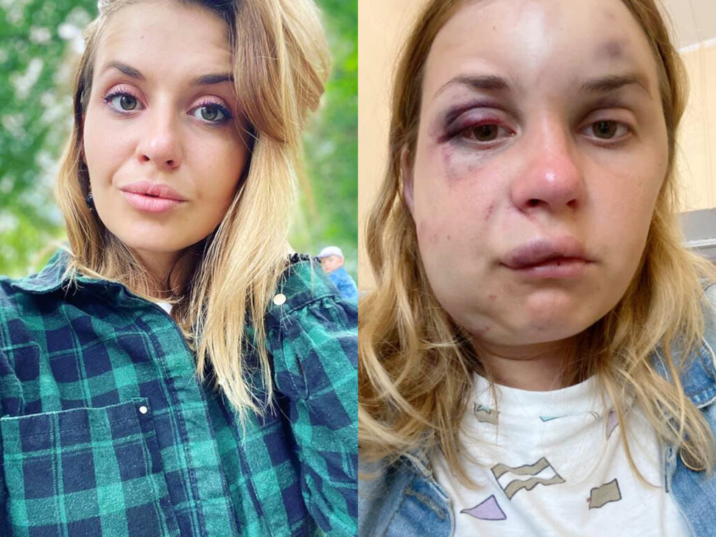 <b>Женщины (и не только) все чаще говорят о нападениях в поездах.</b> Почему это происходит и как защитить себя? - Заборона lugova02 1024x768 - <b>Женщины (и не только) все чаще говорят о нападениях в поездах.</b> Почему это происходит и как защитить себя? - Заборона dqxikeidqxitkant