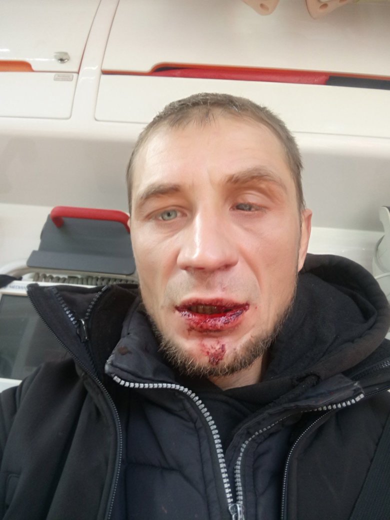 В Киеве титушки избили защитников ландшафтного парка на Никольско-Слободской улице 01 dqxikeidqxiqqeant