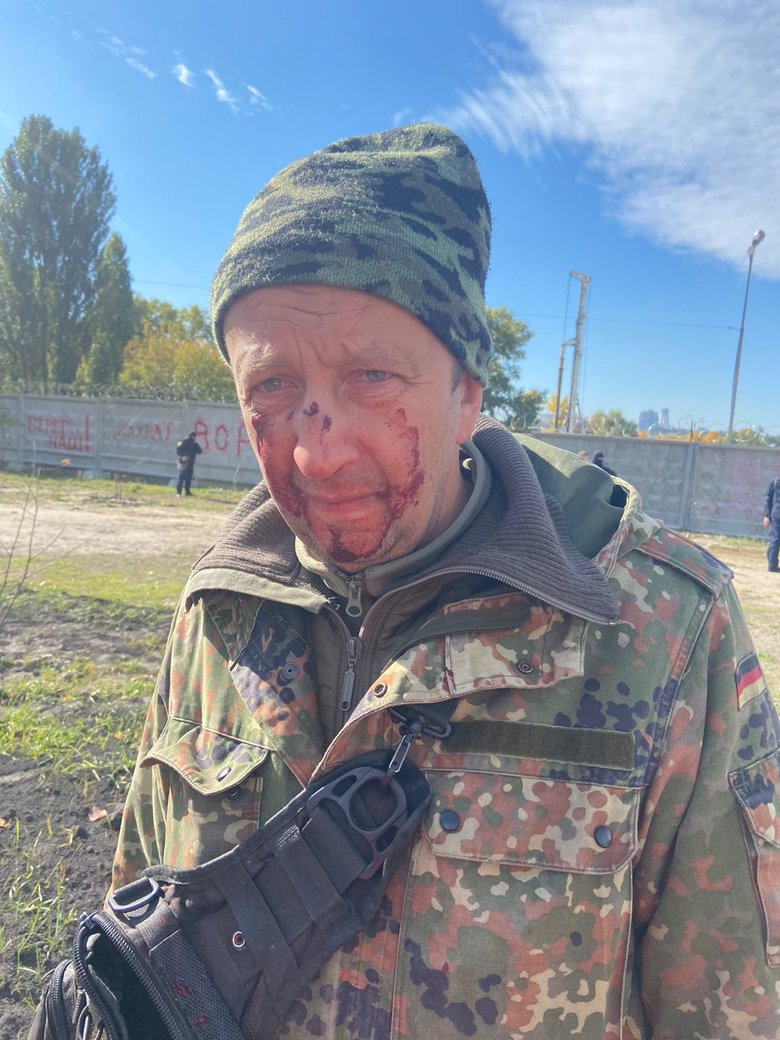 В Киеве титушки избили защитников ландшафтного парка на Никольско-Слободской улице 02