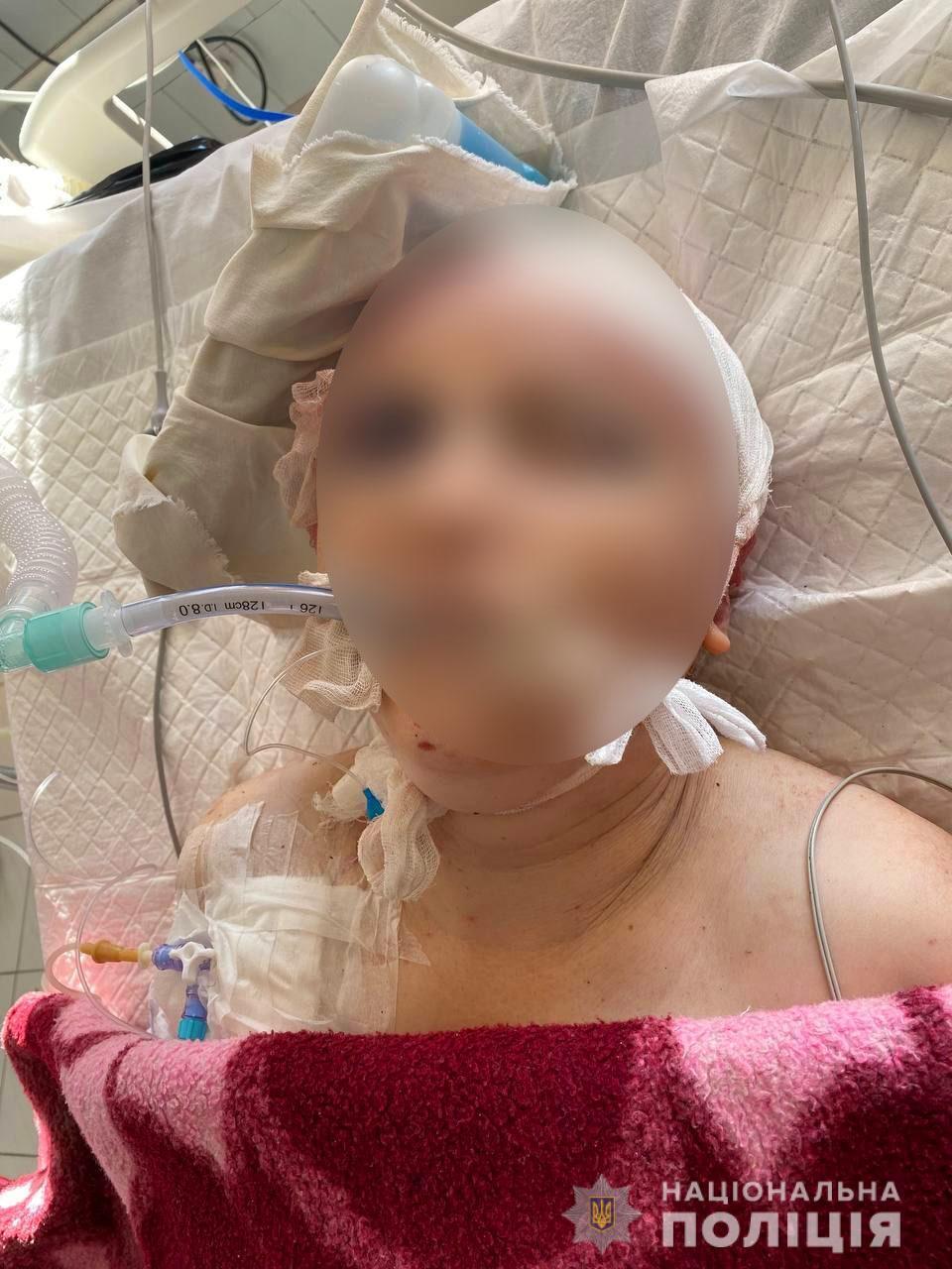 За жизнь матери четверых детей борются врачи. dqxikeidqxiqqeant