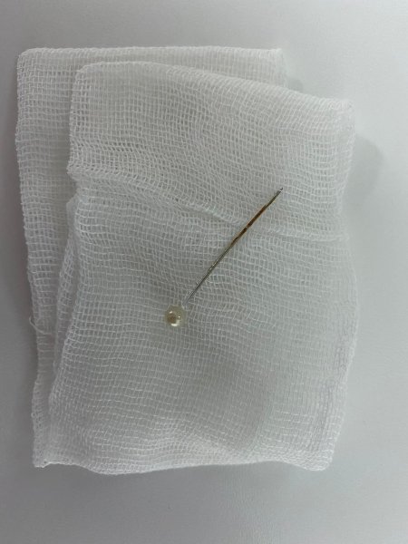 Детские врачи, иголка у ребенка, достать иголку, иголка в горле, детская операция dqxikeidqxitkant