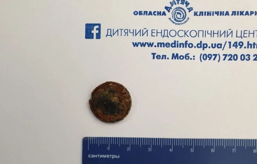 Элемент электропитания повредил пищевод