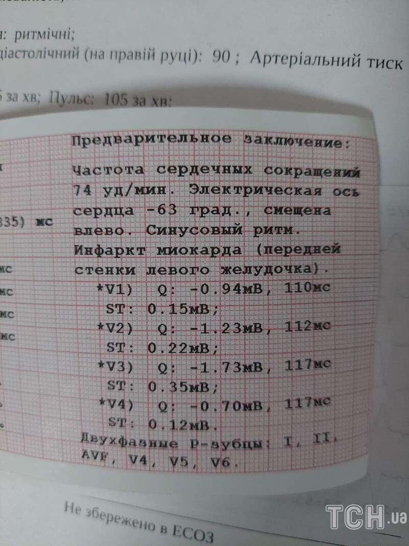 жінку змусили роздягнутися в Епіцентрі