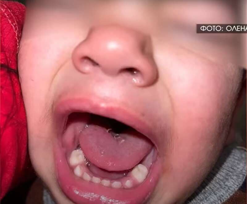 В больнице Адему наложили несколько швов dqxikeidqxitkant