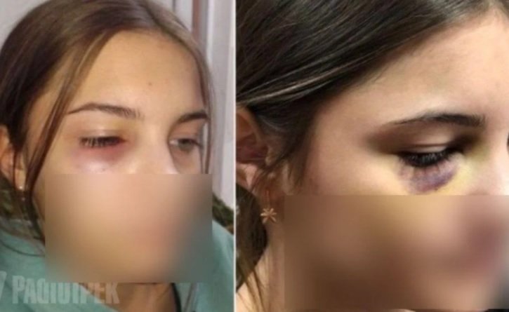 Пострадавшая девочка dqxikeidqxitkant