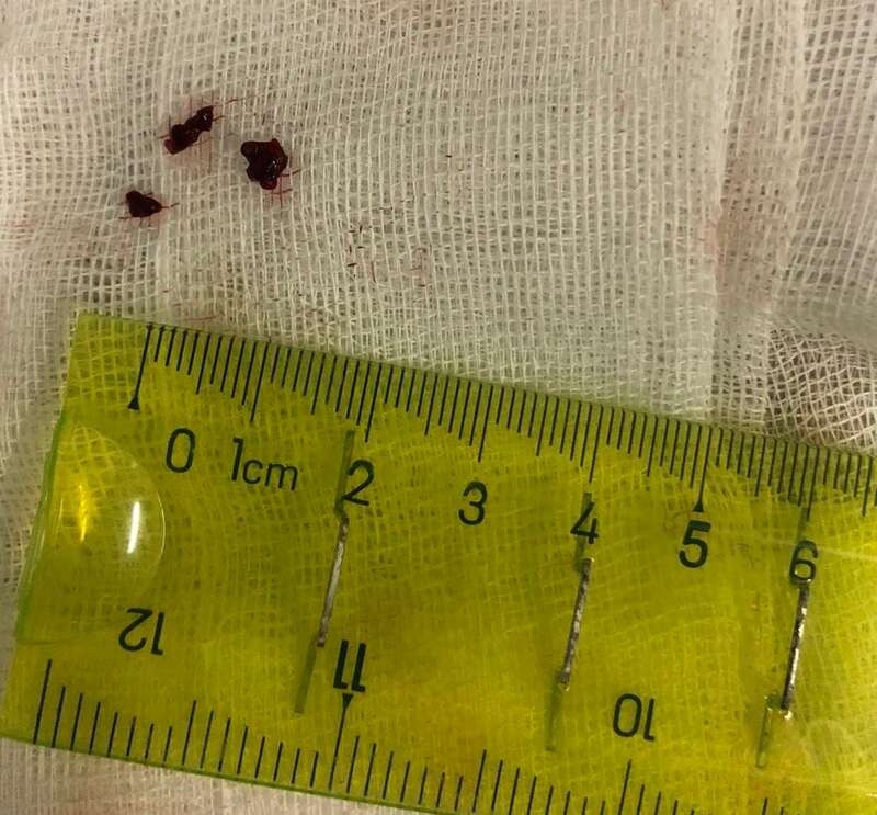 Операция dqxikeidqxiqqeant