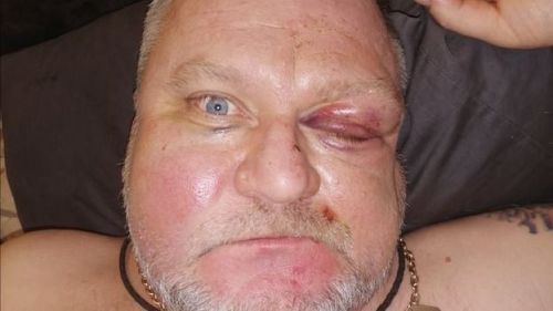 41515 dqxikeidqxitkant