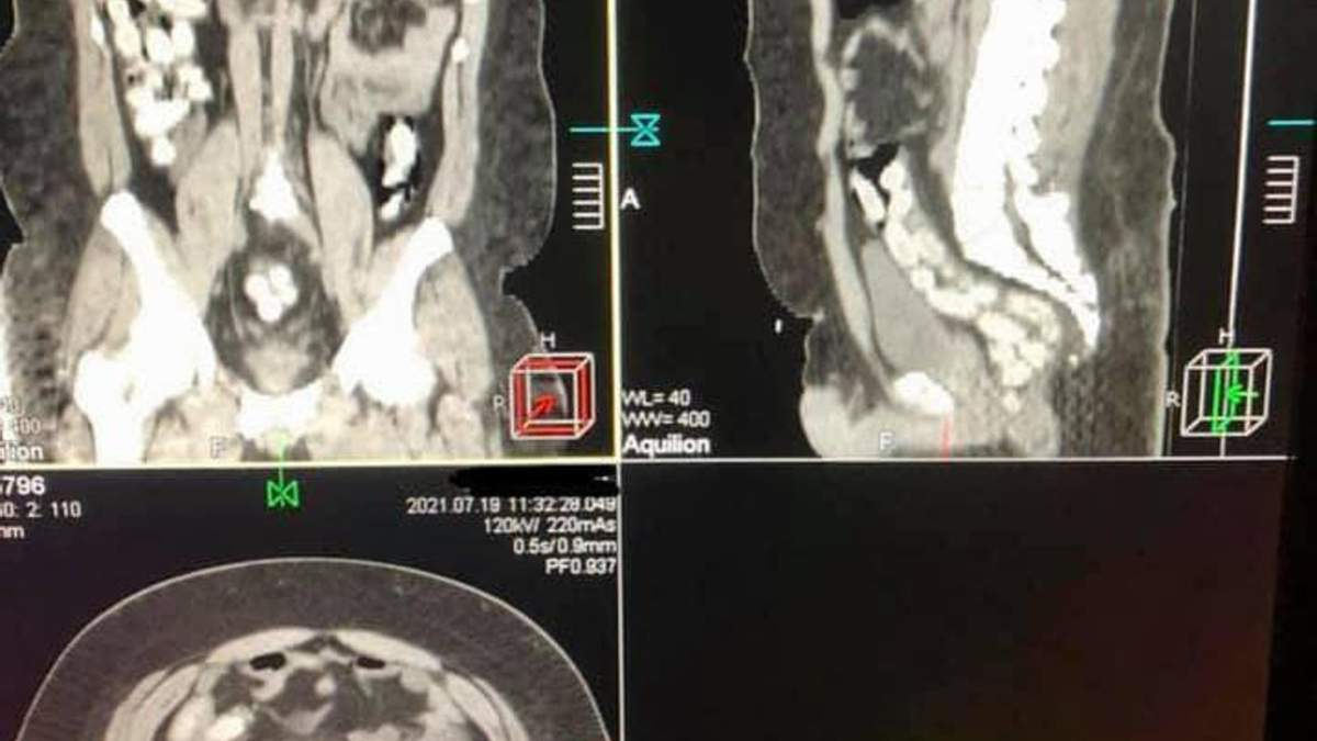         :     dqxikeidqxitkant