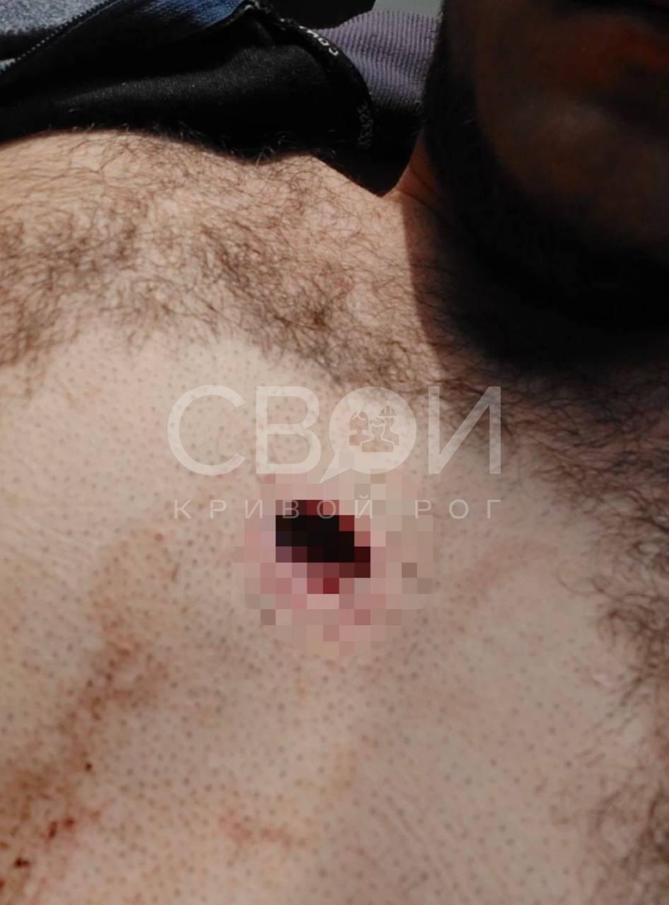 Стрелка задержали и уже возбудили уголовное производство dqxikeidqxitkant