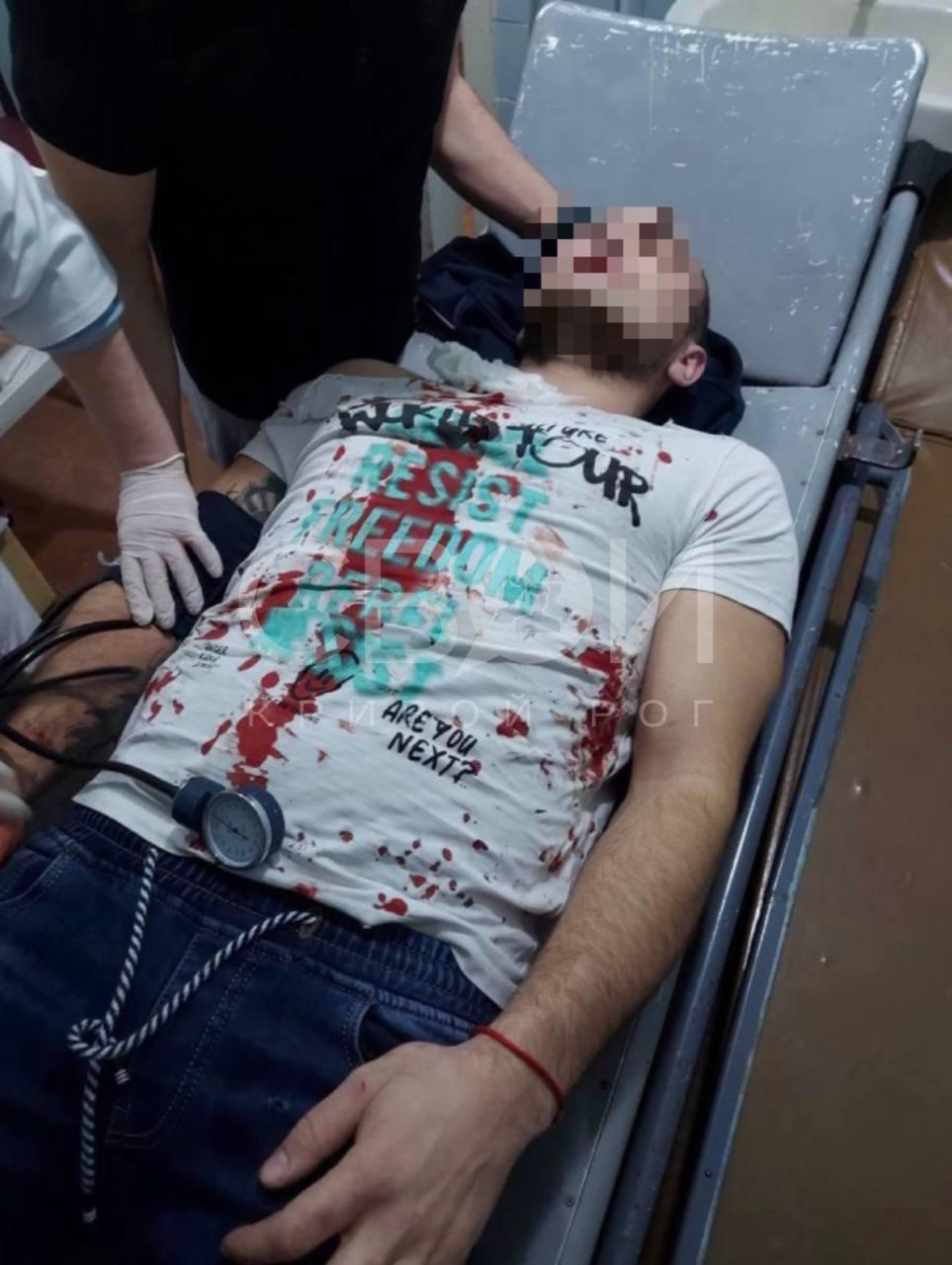 Пострадавшему ампутировали палец