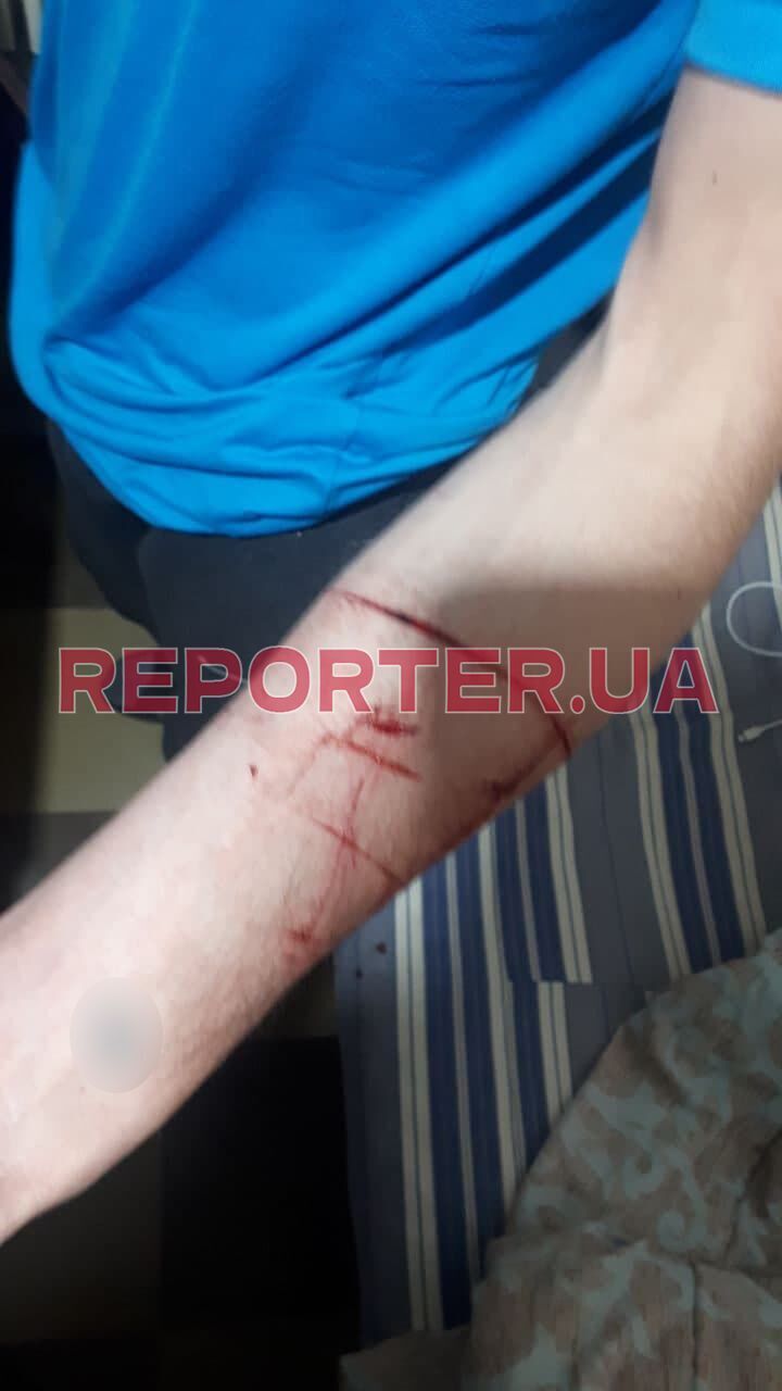 У парня обнаружили порезы на руках