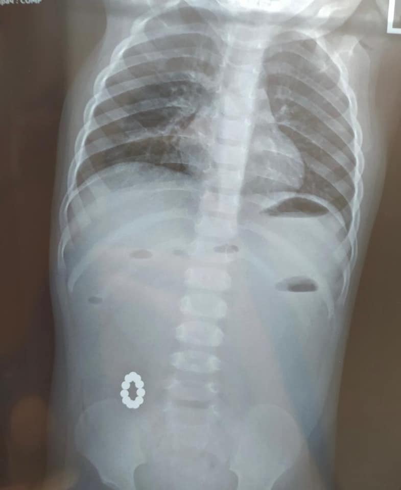   -       () dqxikeidqxitkant