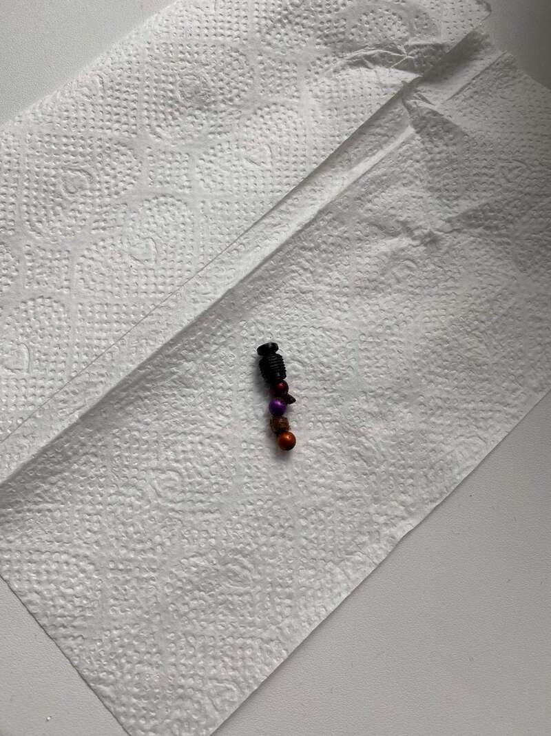 Проковтнула небезпечну іграшку: львівські лікарі врятували 2-річну дівчинку Проковтнула небезпечну іграшку: львівські лікарі врятували 2-річну дівчинку