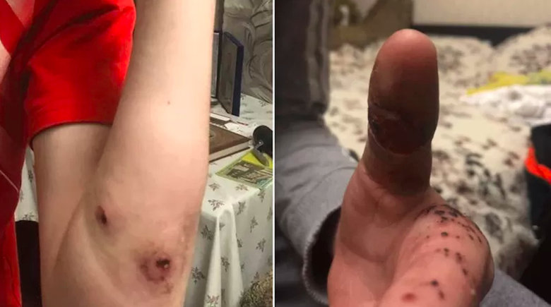 Оккупанты в Буче застрелили отца на глазах 14-летнего сына 02