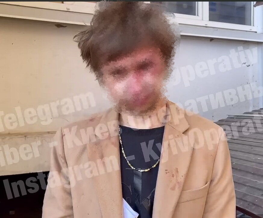 Якобы злоумышленник был в состоянии наркотического опьянения. dqxikeidqxitkant