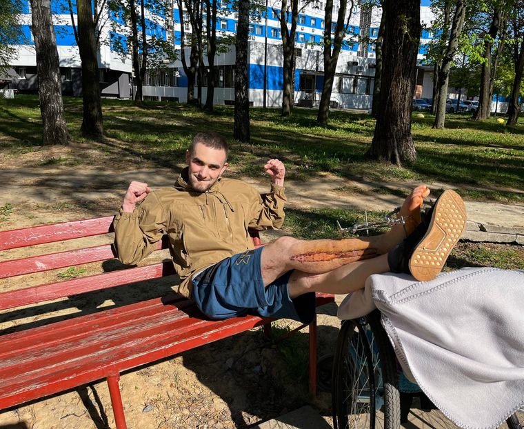Дмитро з пораненням ноги, яке він отримав під час боїв за школу в Харкові