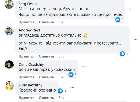 ’’Супергерої існують’’: українці влаштували овації Масі Найєму, який показав обличчя після тяжкого поранення. Фото