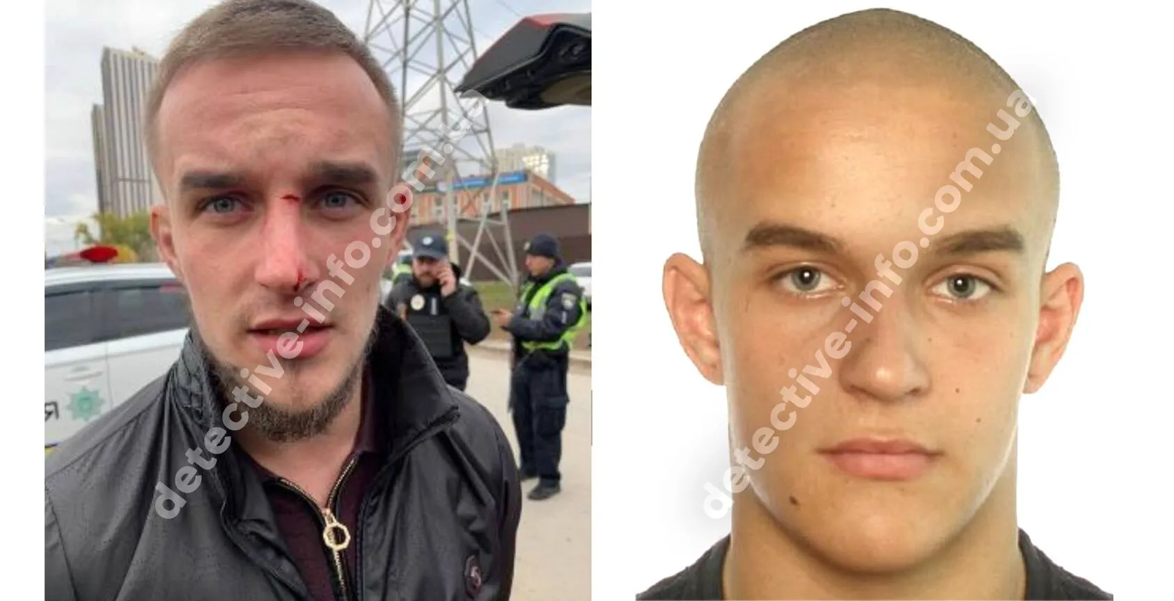 Убийцей военного в Киеве оказался украинский чемпион – СМИ dqxikeidqxiqqeant