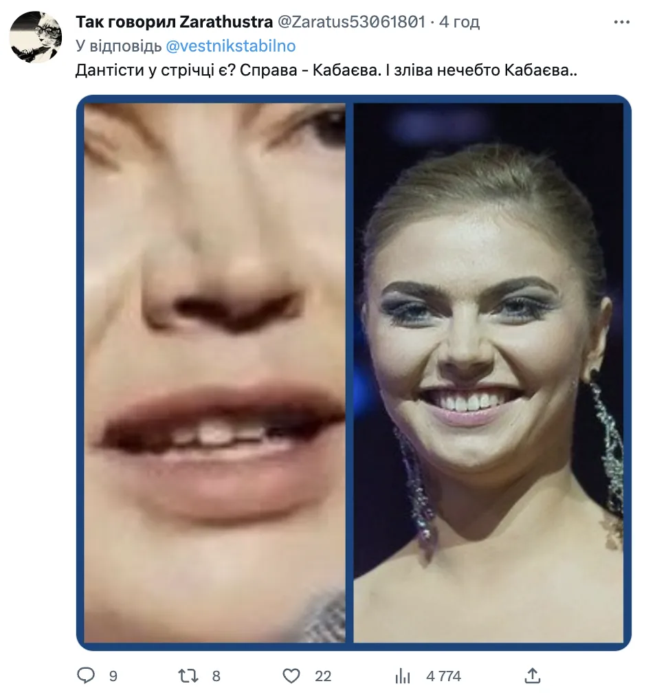 ’’Філери передалися статевим шляхом?’’ Аліну Кабаєву не впізнали після пластики, в мережі хвиля хейту. Відео