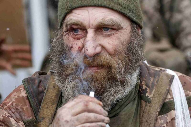 травмированный военный