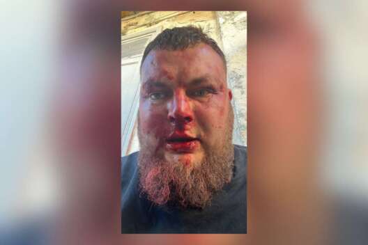 Одесский активист Ганул обвинил Труханова в заказном нападении-1200x800 dqxikeidqxitkant