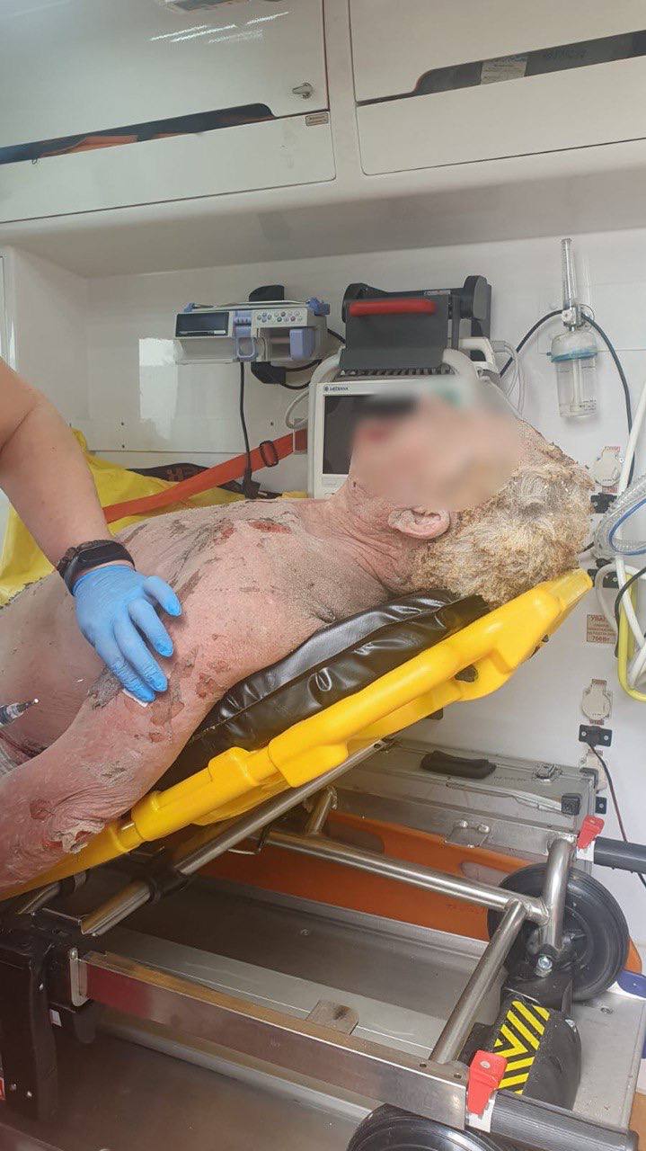 В будинку в Бучі вибухнув балон з газом. Постраждав господар 05 В будинку в Бучі вибухнув балон з газом. Постраждав господар 05