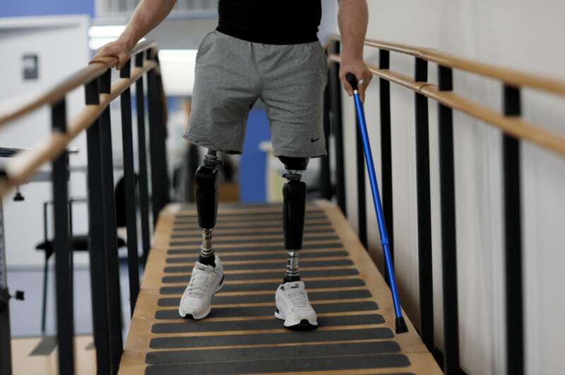 Протезирование украинских защитников dqxikeidqxitkant