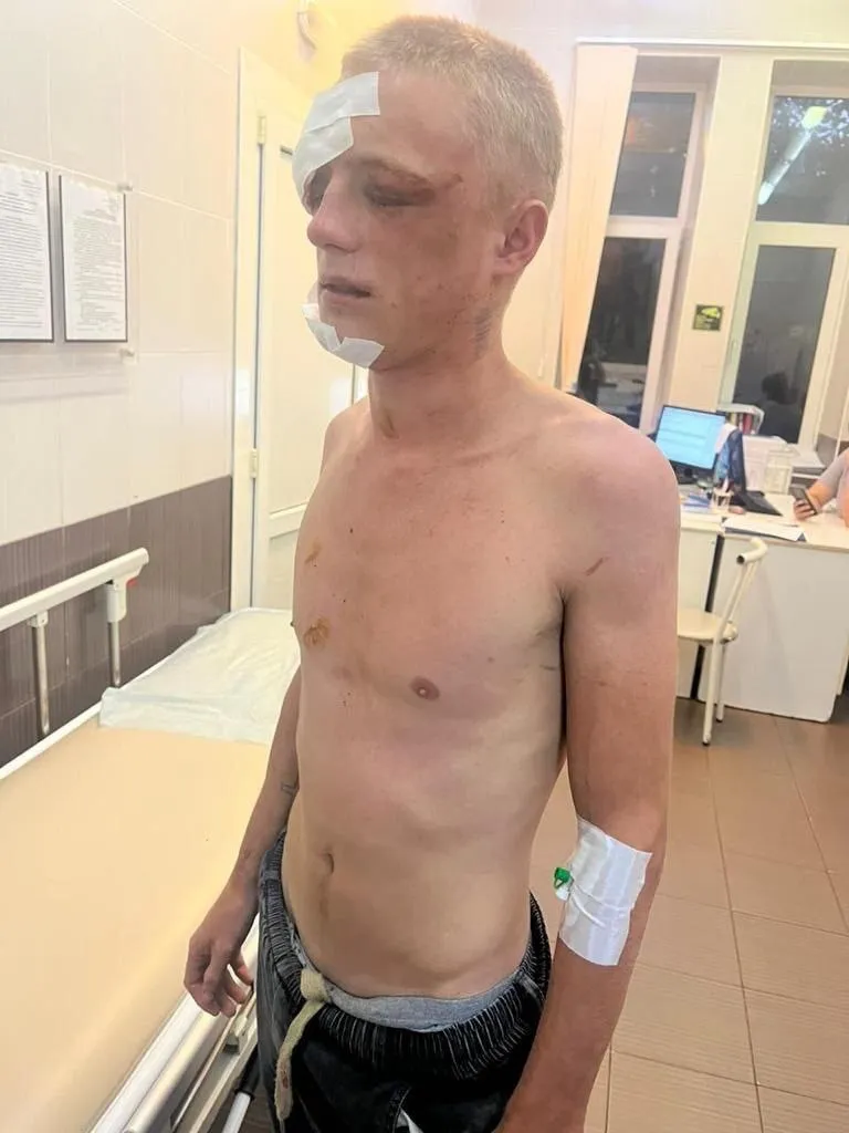 В России насмерть забили камнями двух